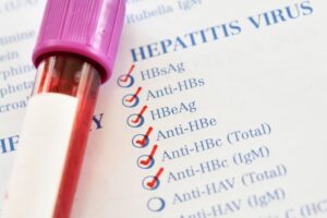 Ação de saúde leva testagem e vacinação contra hepatites a moradores de Sussuarana