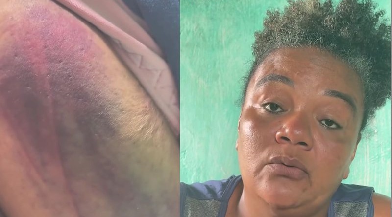 Ambulante relata agressão atribuída a agente da Guarda Municipal durante Carnaval em Salvador